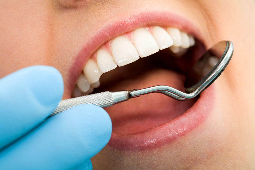 dental crowns in burnaby